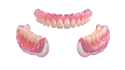 Fototapeta premium a set of realistic 3d dentures, isolated on transparent background, showing upper and lower sets