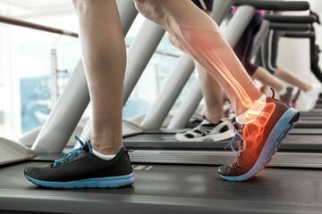Jogger experiencing ankle pain