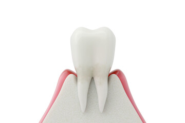 Gingivitis The Early Stage of Gum Disease with Plaque Buildup and Inflammation. 3D Medical Render.