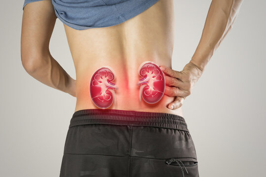 Image shows lower back kidney pain, a common symptom of chronic kidney disease or acute renal failure. Early diagnosis and nephrology care can help slow disease progression.