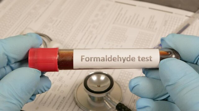 Doctor showing formaldehyde test tube