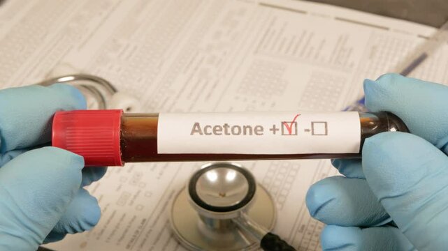 Doctor showing acetone positive blood test tube