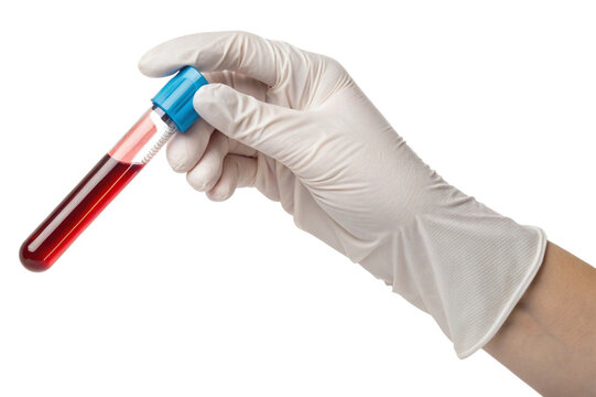 Hand in white glove holding blood sample test tube isolated on transparent background