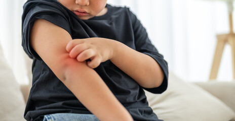 Young asian boy concerned expression itch or skin irritation, children allergy, particularly those related to skin care and health, childhood, health, skin care and medical attention daily life