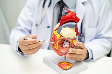 Cardiovascular disease CVD, Asian doctor holding human anatomy model for learn and treat heart...