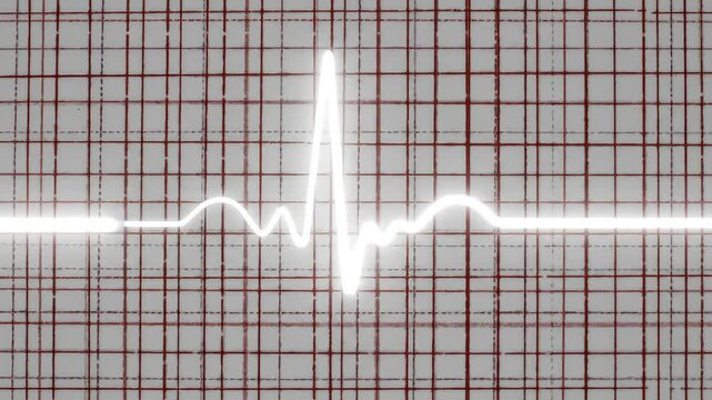 Understanding the ECG A Visual Guide to Heart Rhythm
