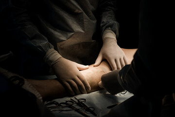 Surgeon manipulates catheter during EVLA treatment. Focus on sterile gloves, fiber optics, and...