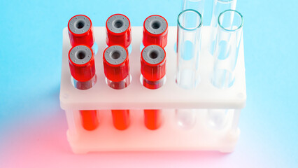 White lab bench with a rack of red and clear tubes. The tubes are labeled with numbers and the rack is on a blue background