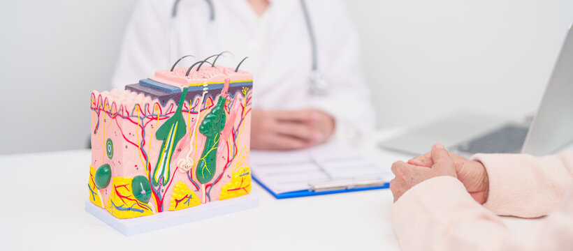 woman Patient consultation Dermatologist with anatomy of skin and hair. Skin disease and Hair loss, Systemic Lupus Erythematosus or SLE, world lupus day, May Melanoma and Skin Cancer Awareness month - Powered by Adobe