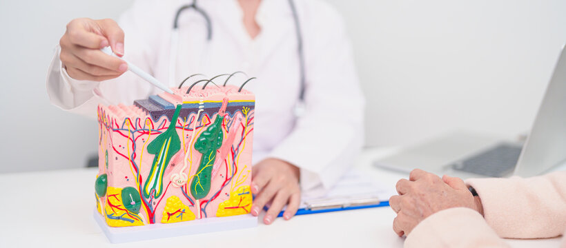 woman Patient consultation Dermatologist with anatomy of skin and hair. Skin disease and Hair loss, Systemic Lupus Erythematosus or SLE, world lupus day, May Melanoma and Skin Cancer Awareness month