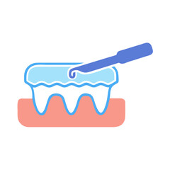 Dental procedure illustration: tooth with caries treated by dentist