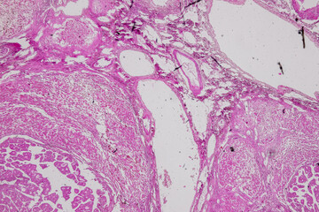 Pathology and Histology Tissue of Mammals under microscope.