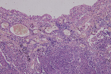 Pathology and Histology Tissue of Mammals under microscope.