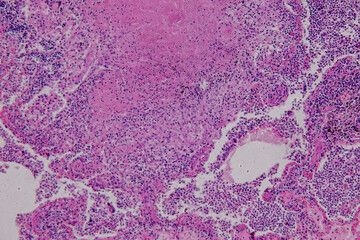 Pathology and Histology Tissue of Mammals under microscope.