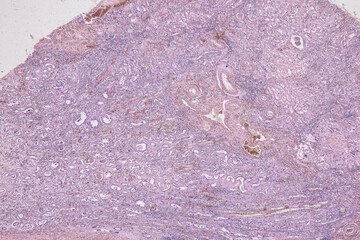 Pathology and Histology Tissue of Mammals under microscope.