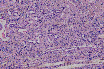 Pathology and Histology Tissue of Mammals under microscope.