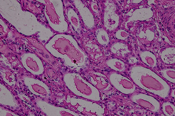 Pathology and Histology Tissue of Mammals under microscope.