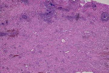 Pathology and Histology Tissue of Mammals under microscope.