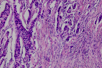 Pathology and Histology Tissue of Mammals under microscope.