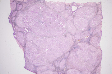 Pathology and Histology Tissue of Mammals under microscope.