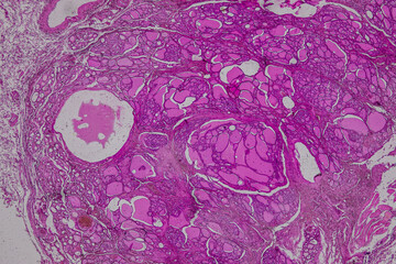 Pathology and Histology Tissue of Mammals under microscope.
