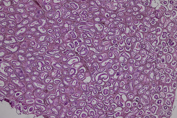 Pathology and Histology Tissue of Mammals under microscope.