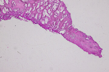 Pathology and Histology Tissue of Mammals under microscope.