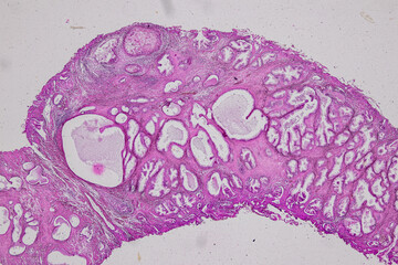Pathology and Histology Tissue of Mammals under microscope.