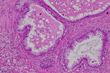 Pathology and Histology Tissue of Mammals under microscope.