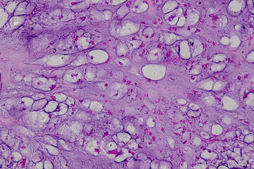 Pathology and Histology Tissue of Mammals under microscope.