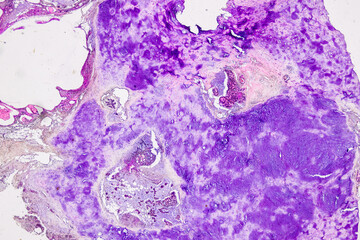 Pathology and Histology Tissue of Mammals under microscope.
