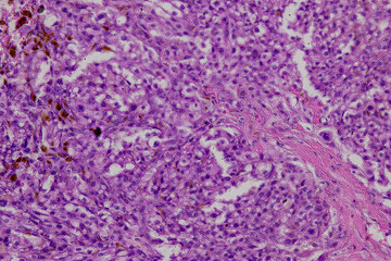 Pathology and Histology Tissue of Mammals under microscope.