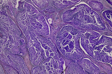 Pathology and Histology Tissue of Mammals under microscope.