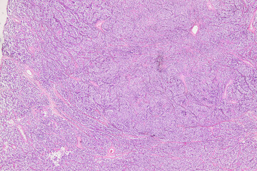 Pathology and Histology Tissue of Mammals under microscope.