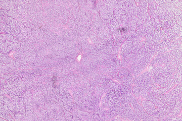 Pathology and Histology Tissue of Mammals under microscope.