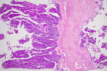 Pathology and Histology Tissue of Mammals under microscope.