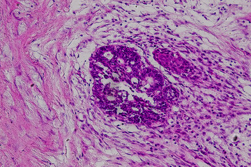 Pathology and Histology Tissue of Mammals under microscope.