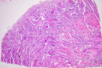 Pathology and Histology Tissue of Mammals under microscope.