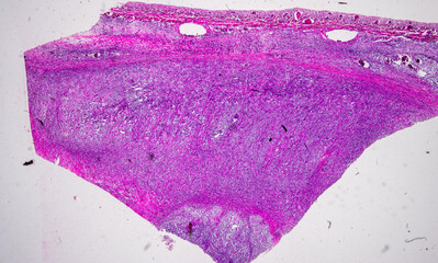Pathology and Histology Tissue of Mammals under microscope.