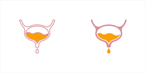 Empty and Full Urinary bladder. Vector cartoon flat anatomical icon color illustration. Bladder isolated on white background. Health care medical sign. Design element for urology.