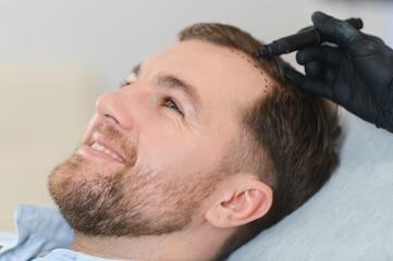 Fototapeta premium Side view of handsome man getting hair treatment at beauty salon. Man having mesotherapy session at aesthetic clinic, therapist hands in gloves making injection in scalp