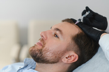 Aesthetic medicine. Doctor trichologist outlines the area of baldness on the client's head with a...