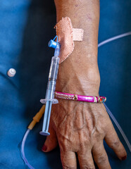 injection thorough cannula inserted in patient’s hand during daytime indoors