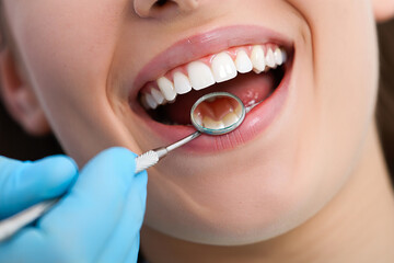 Obraz premium Dentist examining a woman s healthy white teeth with a mirror