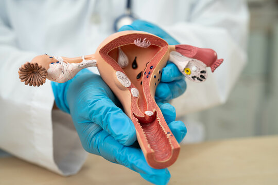 Uterus, doctor holding human anatomy model for study diagnosis and treatment in hospital.