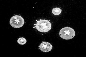 Naklejka premium Microscopic view of multiple, round, crystalline structures. Dark background. Complex, symmetrical patterns