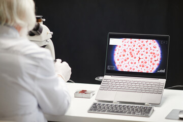Caucasian woman analyzing microscope slide while observing magnified cell structure on laptop...