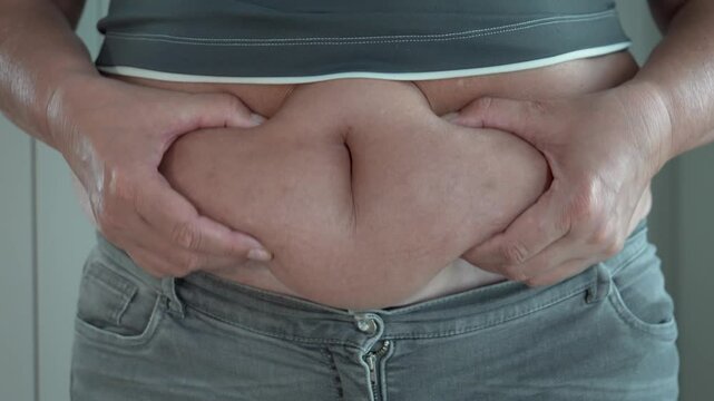 Overweight woman wearing casual clothes, grabbing excess belly fat with hands. Female expressing concern about body shape and weight-related health challenges. Overeating and sedentary lifestyle