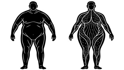 Obesity Illustration Showing Body Fat Over Muscle Structure