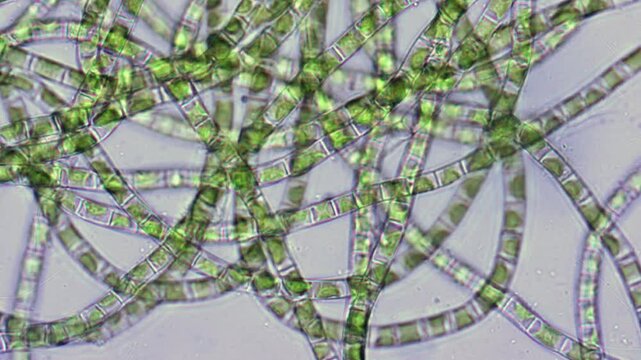 Enlarged filamentous algae under a microscope.